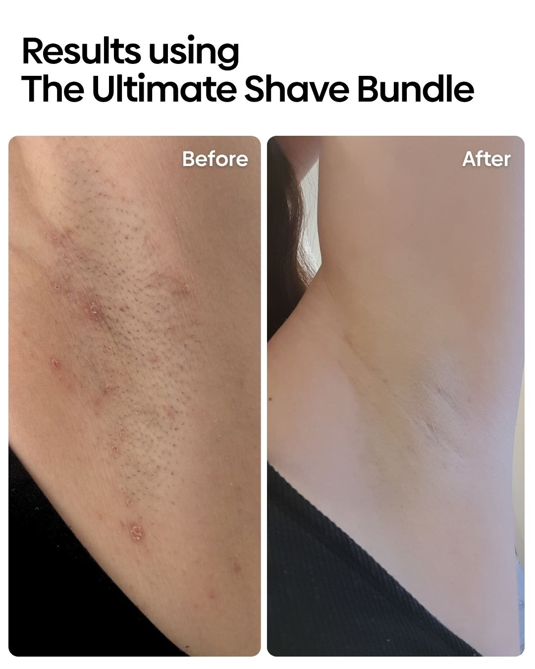 Ultimate Shave Care Bundle
