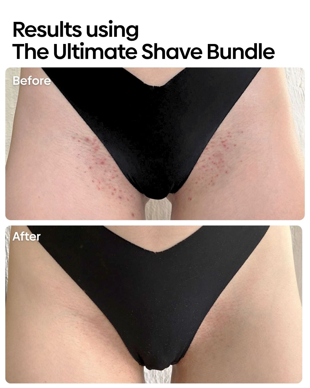 Ultimate Shave Care Bundle