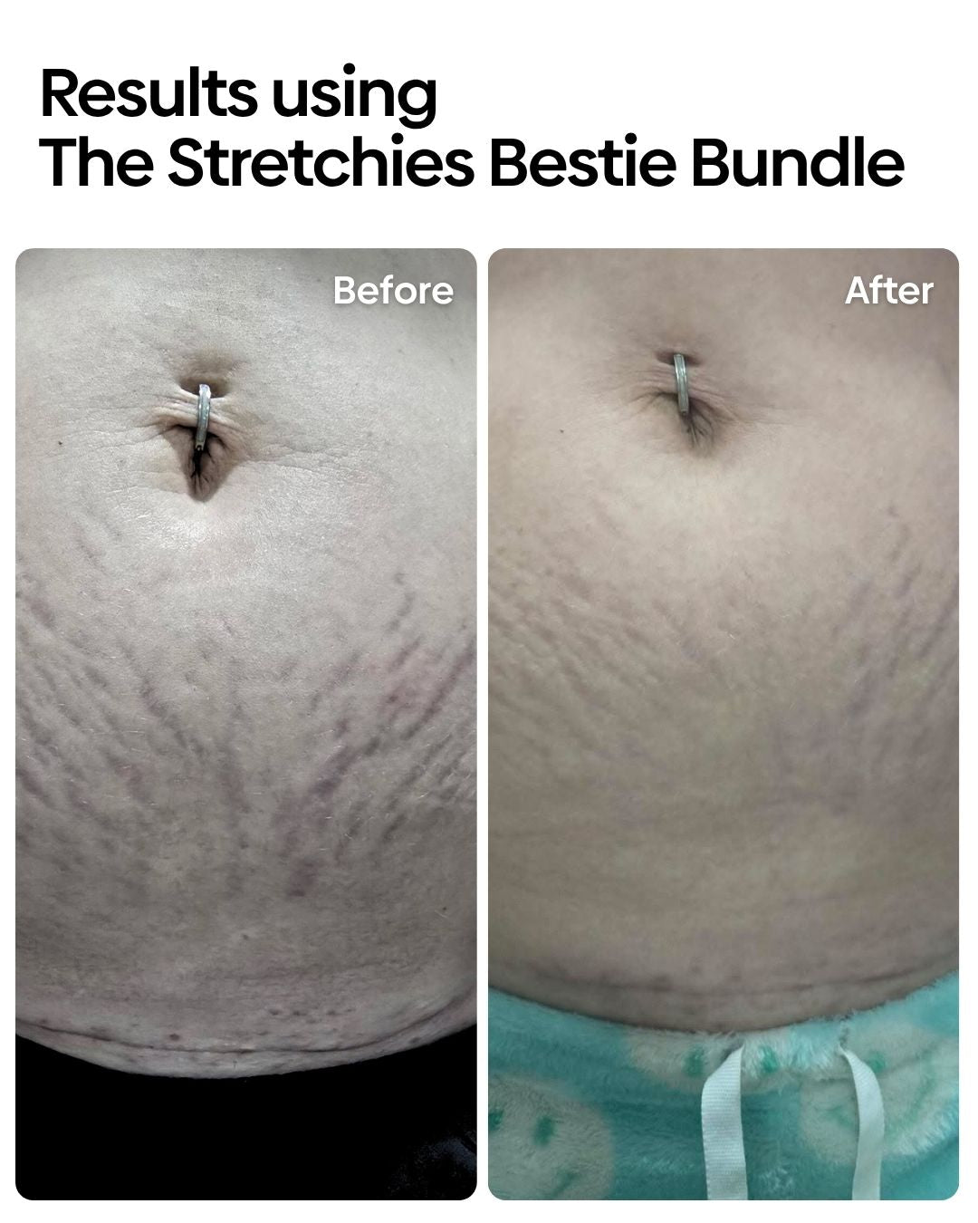 Stretchies Bestie Bundle