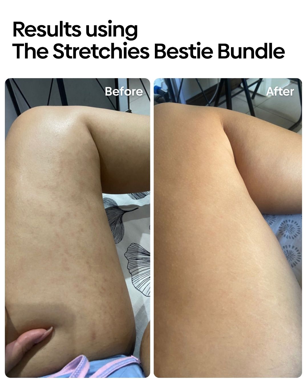 Stretchies Bestie Bundle